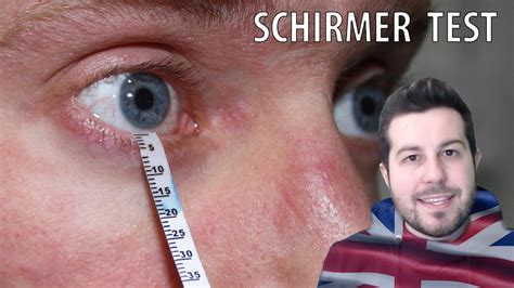 tear test youtube|positive schirmer's test.